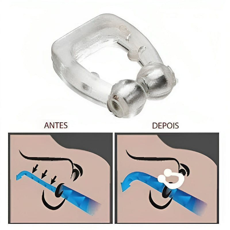 FluxAir© - Dilatador Nasal Anti-Ronco (SOLUÇÃO CONTRA RONCO E A APNÉIA)